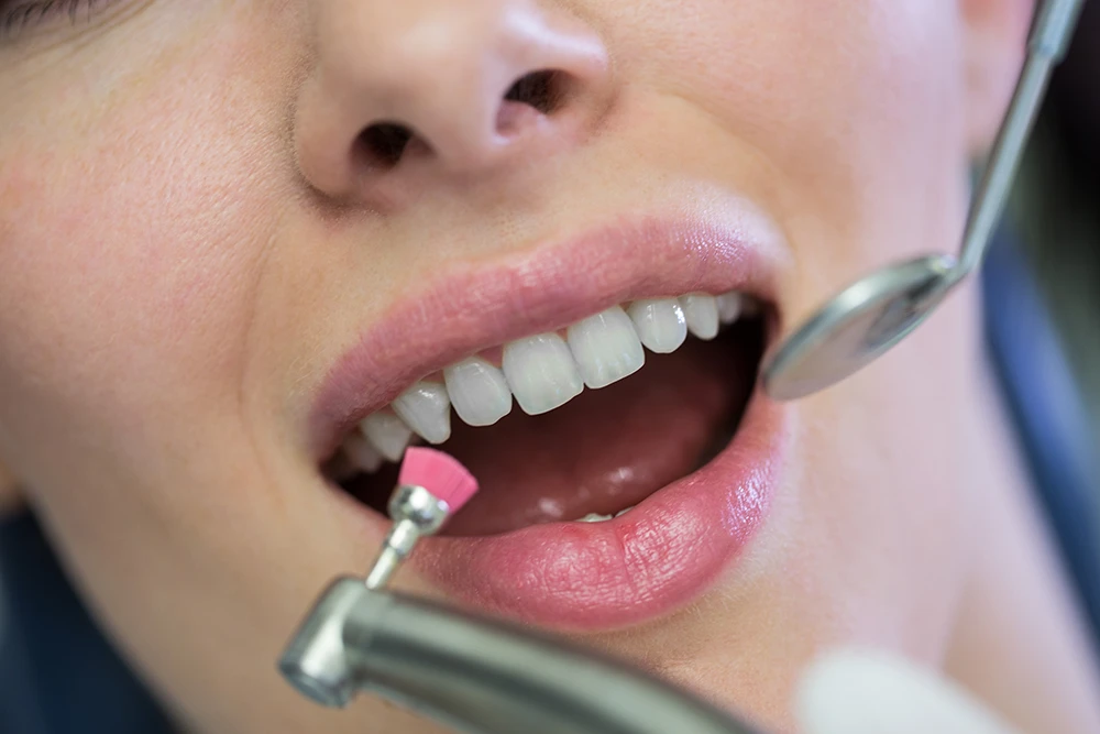 Patient receiving professional teeth cleaning at Premier Dentistry in Gresham, OR