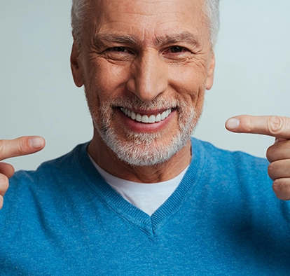 Illustration of Full Mouth Dental Implant